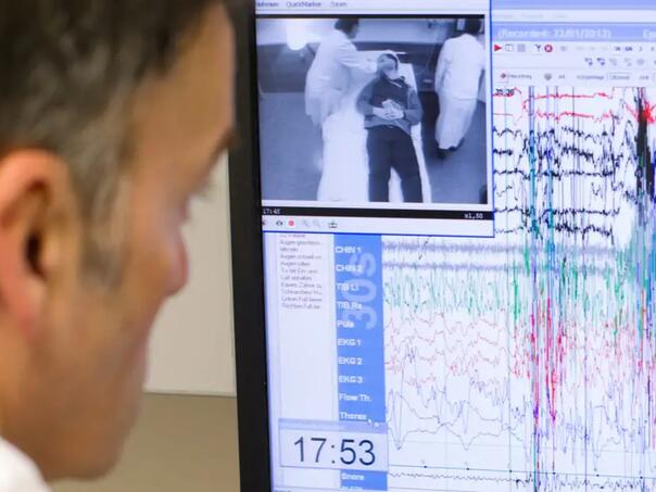AI već nakon jedne noći sna prepoznaje rizik od više od 130 bolesti AI već nakon jedne noći sna prepoznaje rizik od više od 130 bolesti